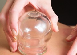 massage cupping